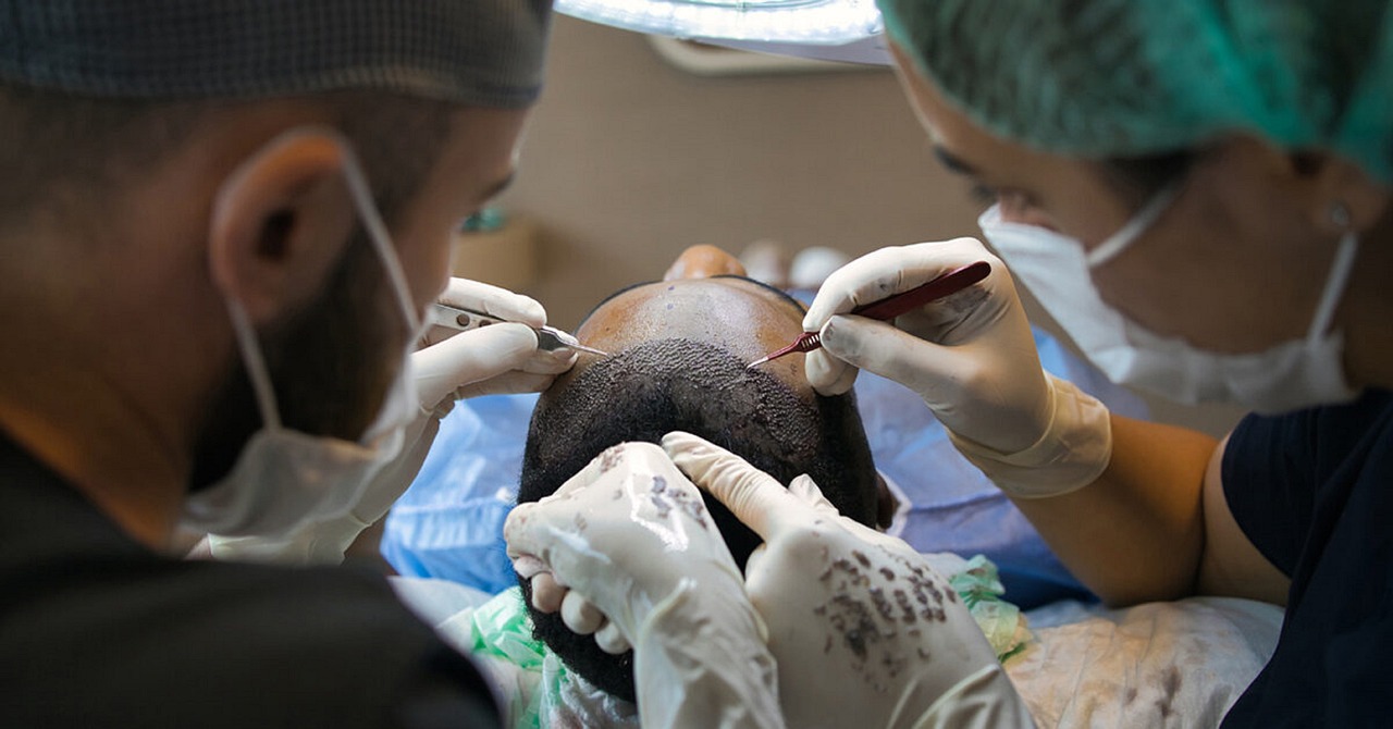 Hair transplant procedure